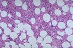 Medium-power microscope image of normal marrow
