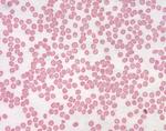 Blood smear of healthy patient